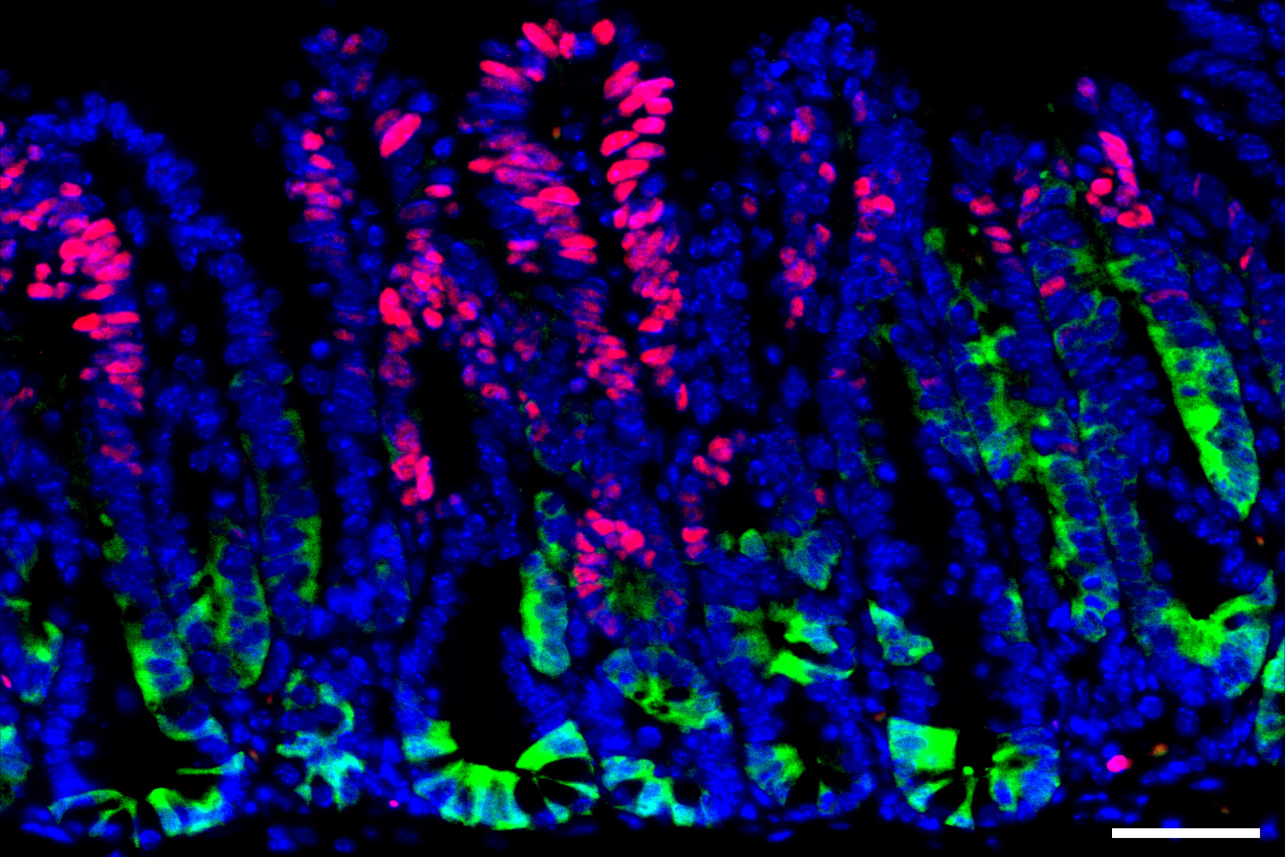 How early-stage cancer cells evade the immune system