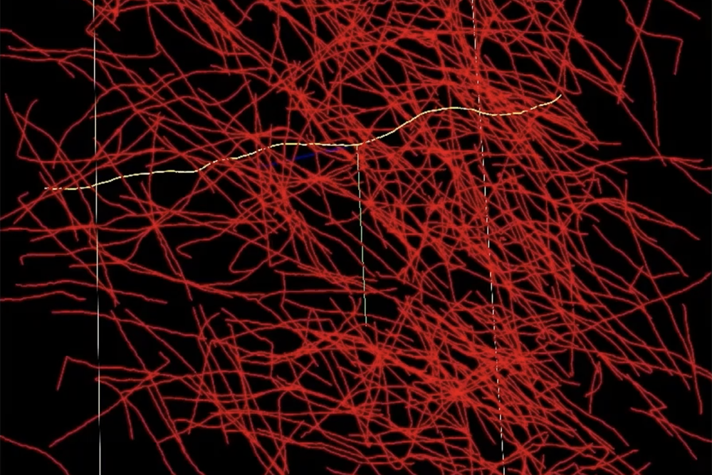 Open Source Tool Aids Brain Research and Mapping Techniques