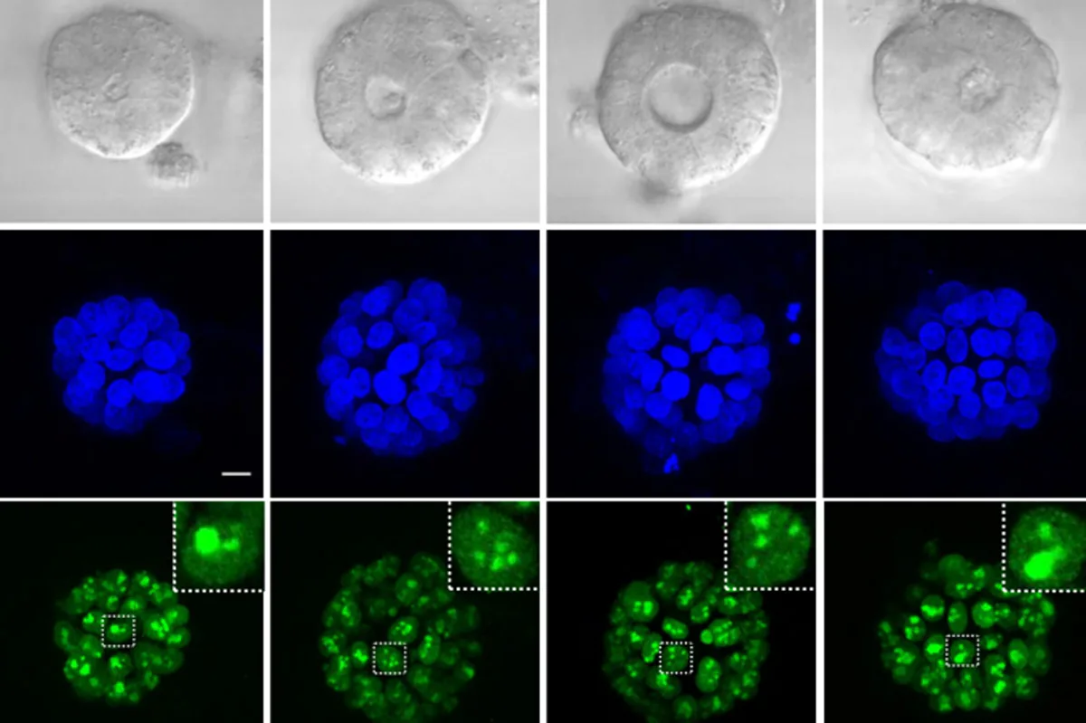 New Mechanism Found for Old Cancer Drug by Biologists