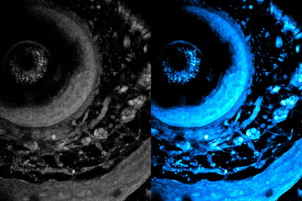 Noninvasive imaging method penetrates deeper into tissue