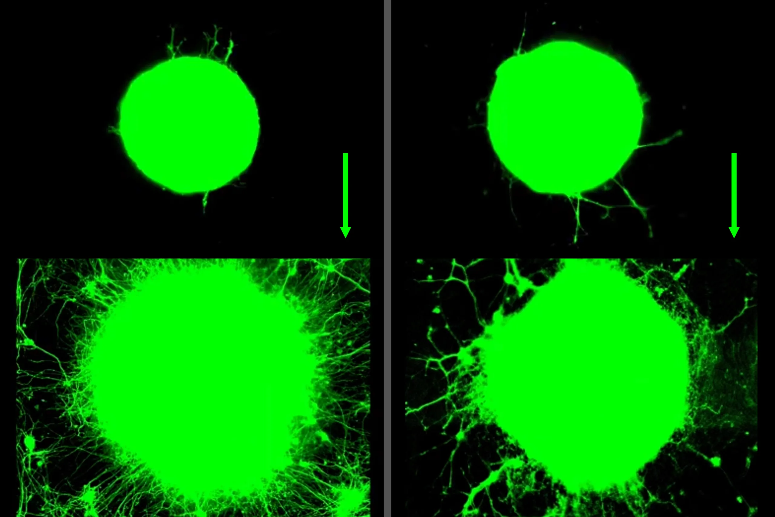 Study shows exercise boosts neuron growth through muscles